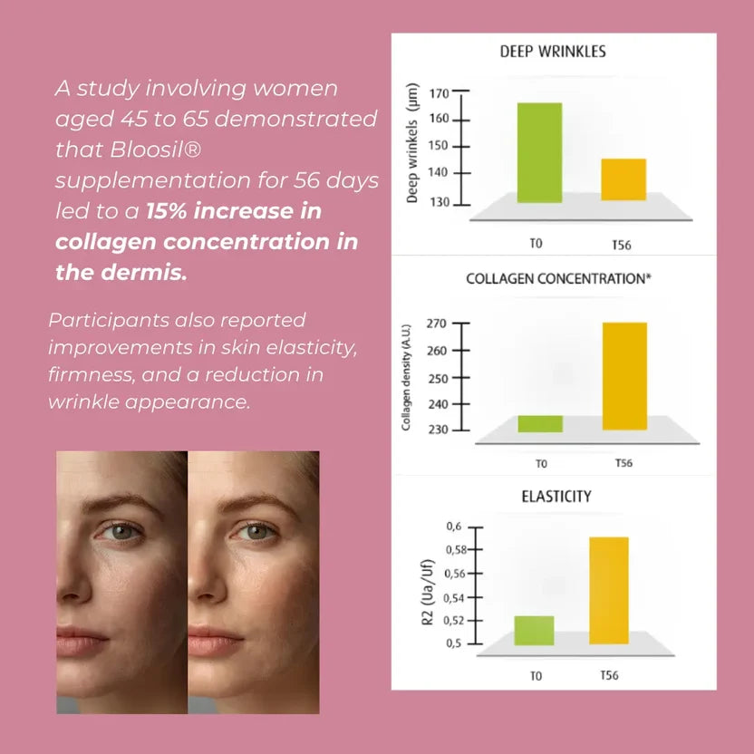 Silica Supplement (Bloosil)
